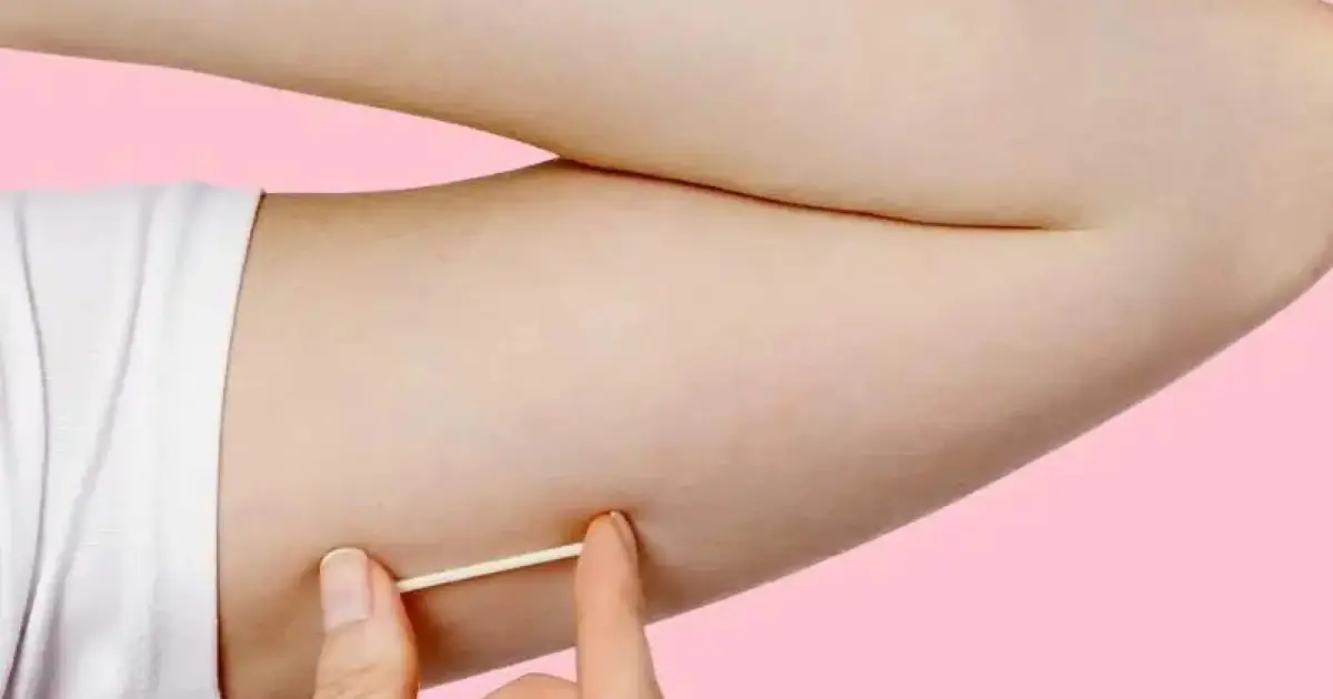 Contraception Services Narangba